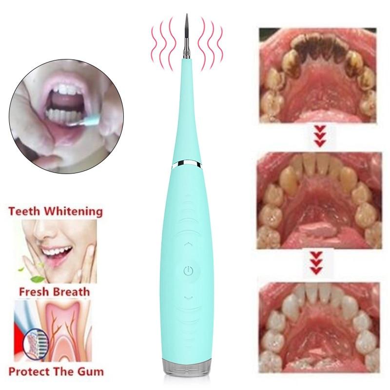 Ultrasonic Teeth Cleaner