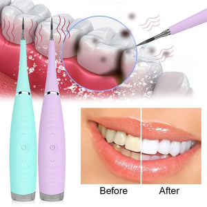 Ultrasonic Teeth Cleaner